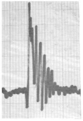 strip chart recording