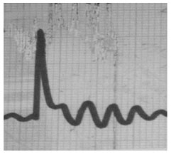 second strip chart recording